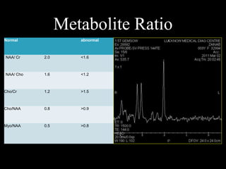 Metabolite Ratio
Normal abnormal
NAA/ Cr 2.0 <1.6
NAA/ Cho 1.6 <1.2
Cho/Cr 1.2 >1.5
Cho/NAA 0.8 >0.9
Myo/NAA 0.5 >0.8
 