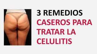 3 REMEDIOS
CASEROS PARA
TRATAR LA
CELULITIS
 