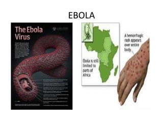 EBOLA
 