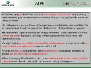 ATPP
•Utilizando una guía hidrofílica de 0.035” se atravesó la obstrucción total crónica y
sobre la misma guía se avanzó un catéter cobra 5F el cuál fue posicionado a nivel del
tronco peroneo.
•Se realizó un test angiográfico a dicho nivel, no comprobándose permeabilidad. No
se visualizaron el llenado de las arterias tibial anterior, tibial posterior ni peronea.
•Se intercambió la guía hidrofílica por una guía de 0.014” y utilizando un catéter de
trombo aspiración Export 6F, se realizó trombo aspiración mecánica a nivel del
segmento ocluido.
•Se logró aspirar gran cantidad de material trombótico fresco, a pesar de lo cuál no
pudo recanalizarse exitosamente la obstrucción total.
•Debido al riesgo de comprometer con microembolias la circulación colateral, se
decidió dar por terminado el procedimiento.
•El control angiográfico final demostró una sensible mejoría a nivel de la circulación
colateral con un llenado más rápido de la arteria pedia y el arco plantar.

 