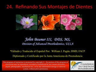  	
  24.	
  	
  Reﬁnando	
  Sus	
  Montajes	
  de	
  Dientes	
  

John Beumer III, DDS, MS,
Division of Advanced Prosthodontics, UCLA
*Editado y Traducido al Español Por: William J. Pagán, DMD, FACP
Diplomado y Certificado por la Junta Americana de Prostodoncia
This program of instruction is protected by copyright ©. No portion of this program of
instruction may be reproduced, recorded or transferred by any means electronic,
digital, photographic, mechanical etc., or by any information storage or retrieval
system, without prior permission.

 