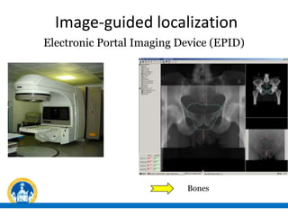 Management dell'organ motion nei trattamenti stereo-RT e ...