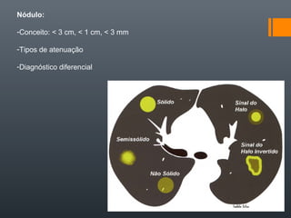Nódulo:
-Conceito: < 3 cm, < 1 cm, < 3 mm
-Tipos de atenuação
-Diagnóstico diferencial