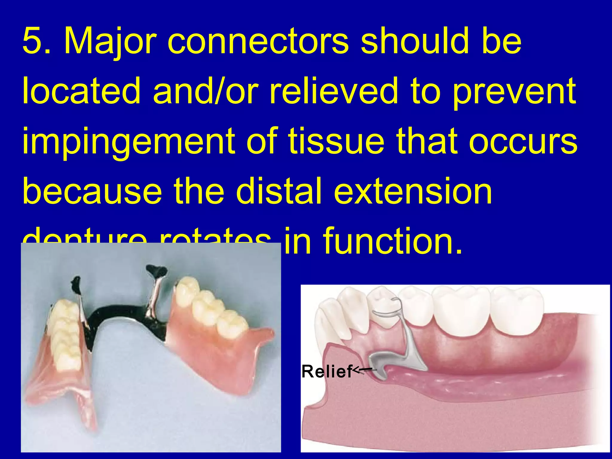 24. major connectors | PPT
