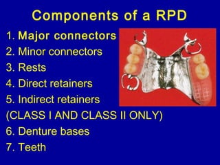 Mn Class 1 Rpd 24. major connectors | PPT