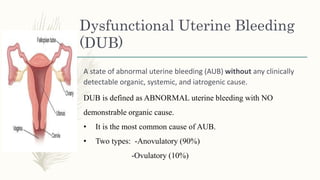 Dysfunctional Uterine Bleeding
(DUB)
A state of abnormal uterine bleeding (AUB) without any clinically
detectable organic, systemic, and iatrogenic cause.
DUB is defined as ABNORMAL uterine bleeding with NO
demonstrable organic cause.
• It is the most common cause of AUB.
• Two types: -Anovulatory (90%)
-Ovulatory (10%)
 