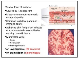 Severe form of malaria
Caused by P. Falciparum
Most common non-traumatic
encephalopathy
Common in children and non-
immune adults
Adhering of P. falciparum infected
erythrocytes to brain capillaries
causing coma & death.
Manifested with:
— Coma
— Convulsion
— Hemoglobinuria
on investigation : CSF is normal
on examination : Splenomegaly
 