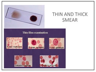 THIN AND THICK
SMEAR
 