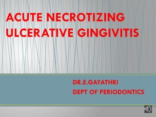 Comprehensive Overview of Acute Necrotizing Ulcerative Gingivitis (ANUG ...