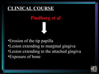 Comprehensive Overview of Acute Necrotizing Ulcerative Gingivitis (ANUG ...