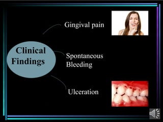Comprehensive Overview of Acute Necrotizing Ulcerative Gingivitis (ANUG ...