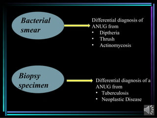 Comprehensive Overview of Acute Necrotizing Ulcerative Gingivitis (ANUG ...