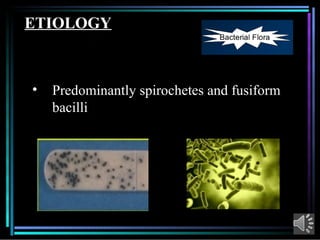 Comprehensive Overview of Acute Necrotizing Ulcerative Gingivitis (ANUG ...