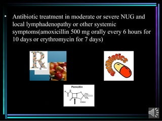 Comprehensive Overview of Acute Necrotizing Ulcerative Gingivitis (ANUG ...