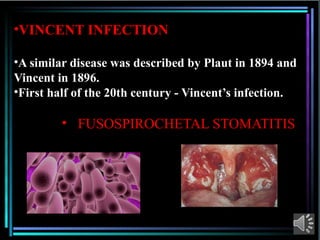 Comprehensive Overview of Acute Necrotizing Ulcerative Gingivitis (ANUG ...