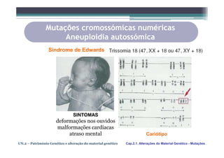 Mutações cromossómicas numéricas
                     Aneuploidia autossómica
                 Síndrome de Edwards




                                SINTOMAS
                      deformações nos ouvidos
                      malformações cardíacas
                           atraso mental                                   Cariótipo
UN.2 – Património Genético e alteração do material genético   Cap.2.1. Alterações do Material Genético - Mutações
 