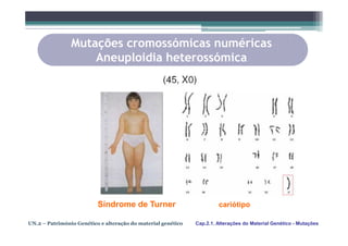 Mutações cromossómicas numéricas
                    Aneuploidia heterossómica




                          Síndrome de Turner                           cariótipo

UN.2 – Património Genético e alteração do material genético   Cap.2.1. Alterações do Material Genético - Mutações
 