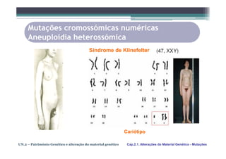 Mutações cromossómicas numéricas
     Aneuploidia heterossómica
                                         Síndrome de Klinefelter




                                                              Cariótipo

UN.2 – Património Genético e alteração do material genético    Cap.2.1. Alterações do Material Genético - Mutações
 