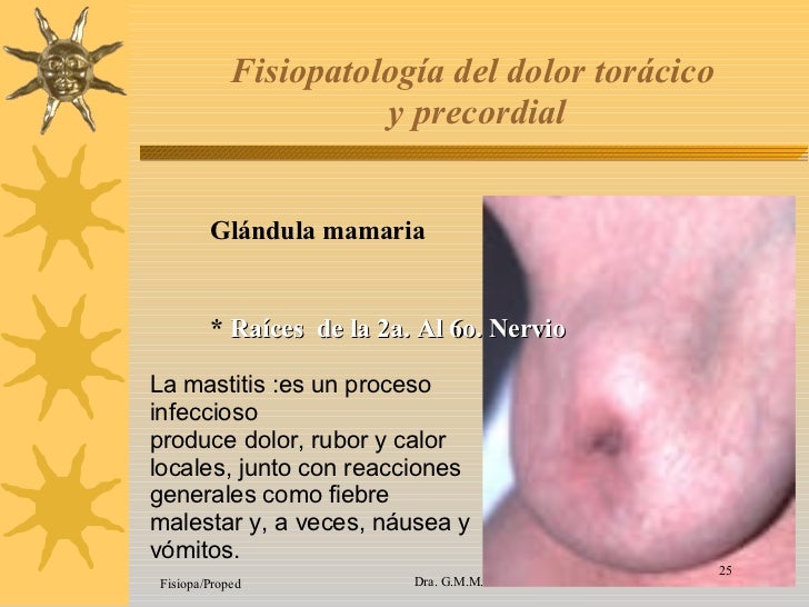 24. Dolor Toracico Y Precordial 24. Dolor Toracico Y Precordial