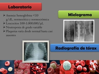 Anemia: hemoglobina <10
g/dL, normocítica y normocrómica
Leucocitos 100-1.000.000/µL
Neutropenia de grado variable
Plaquetas varía desde normal hasta casi
ausentes
Laboratorio
Radiografía de tórax
Mielograma
 