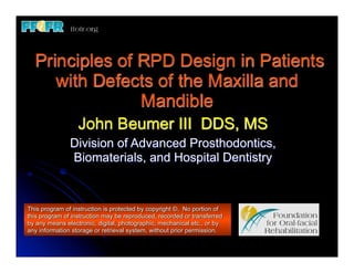 Principles of RPD Design in Patients
     with Defects of the Maxilla and
                Mandible
                  John Beumer III DDS, MS
               Division of Advanced Prosthodontics,
               Biomaterials, and Hospital Dentistry


This program of instruction is protected by copyright ©. No portion of
this program of instruction may be reproduced, recorded or transferred
by any means electronic, digital, photographic, mechanical etc., or by
any information storage or retrieval system, without prior permission.
 