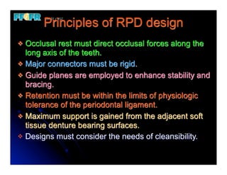Guide Plane Rpd Continous 24.(new)mfp defects and rpd design | PDF