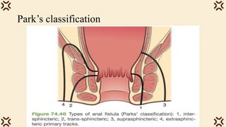 Park’s classification
 