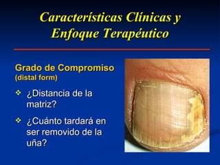 Características Clínicas y Enfoque Terapéutico Grado de Compromiso (distal form) ¿Distancia de la matriz? ¿Cuánto tardará en ser removido de la uña? 
