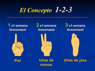 El Concepto  1-2-3   Piel Uñas de manos Uñas de pies 1   x1-semana itraconazol 2   x1-semana itraconazol 3   x1-semana itraconazol 