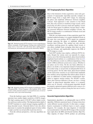 Atlas Of Swept Source Oct And Oct Angiography Youxin Chen Xianzhao Peng ...