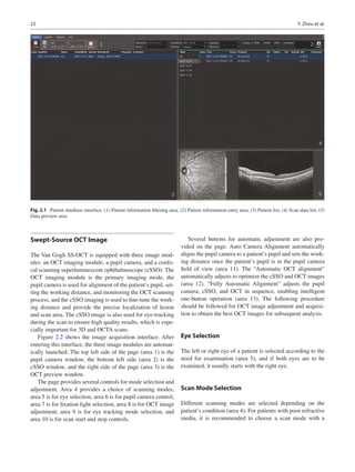 Atlas Of Swept Source Oct And Oct Angiography Youxin Chen Xianzhao Peng ...
