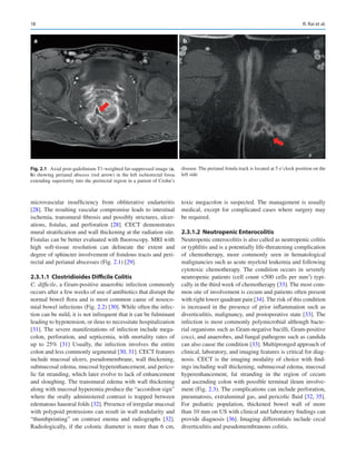 Diseases Of The Abdomen And Pelvis 20232026 Diagnostic Imaging 1st ...