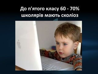 До п'ятого класу 60 - 70%
школярів мають сколіоз
 