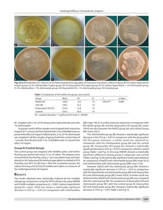 Antifungal Efficacy of Endodontic Irrigants
The Journal of Contemporary Dental Practice, Volume 21 Issue 12 (December 2020) 1327
IIC: Irrigated with 2 mL of 5% doxycycline hydrochloride and with
1% clotrimazole.
In groups I and II, all the samples were irrigated with respective
irrigantsfor1minuteandthenflushedwith5mLofdistilledwaterto
preventtheeffectofirrigant.Followingthis,2mLof1%clotrimazole
was irrigated in all the samples of group II with the contact time of
1 minute, then flushed with 5 mL of distilled water to prevent the
effect of irrigant.
Group III (Control Group)
The control group was irrigated with distilled water, and further
flushing was performed using 15 mL of saline. The aliquots were
removed from the fluid by using a 1 μm inoculation loop and were
placedontheSabouraud4%dextroseagarplatesincubatedat91%
humidity and 36°C for 48 hours. After the incubation period, the
colony-forming units (CFUs) of candida were taken as a measure of
the antifungal activity of irrigants.
Results​
The results obtained were statistically analyzed by the multiple
intergroup comparisons using the SPSS software by using ANOVA
andScheffemultiplecomparisons(p<0.001).Sodiumhypochlorite
(group IA—mean 129.6) has shown a statistically significant
decrease in CFU (p < 0.01) on comparison with chlorhexidine
[(IB) mean 190.2]. A similar result was obtained in comparison with
the NaOCl group (IA) and the doxycycline HCl group [(IC) mean
318.4] and also between the NaOCl group (IA) and control Group
[(III) mean 554.2].
The chlorhexidine group (IB) showed a statistically significant
decrease in the CFU (p < 0.01) in comparison with the doxycycline
HCl (IC) group; moreover, a similar result was obtained on
comparison with the chlorhexidine group (IB) and the control
group (III). Doxycycline HCl group (IC) showed a statistically
significantdecreaseinCFU(p<0.01)incomparisonwiththecontrol
group (Table 1 and Fig. 3). One-way ANOVA showed a statistically
significant difference among group II subgroups and control
(Table 2 and Fig. 4). No statistically significant results were obtained
on comparison of NaOCl with clotrimazole group [(IIA) mean 63.3]
and chlorhexidine with clotrimazole group [(IIB) mean 73.8].
However, NaOCl with the clotrimazole group (IIA) showed a
statistically significant decrease in CFU (p < 0.01) in comparison
withthehypochloriteandclotrimazolegroup(IIA)withdoxycycline
HCl and clotrimazole group [(IIC) mean 250.9]. A similar result was
obtained when NaOCl with clotrimazole group (IIA) was compared
with the control group (III). On comparison of doxycycline HCl and
clotrimazole group (IIC) with the control group III, doxycycline
HCl and clotrimazole group (IIC) showed a statistically significant
decrease in CFUs (p < 0.01) (Table 3 and Fig. 5).
Figs2AtoH:VerificationofC.albicanson4%Sabourauddextroseagarplate:(A)AssuranceofpositiveC.albicansculture;(B)5%sodiumhypochlorite
irrigant group; (C) 2% chlorhexidine irrigant group; (D) 5% doxycycline HCl irrigant group; (E) 5% sodium hypochlorite + 1% clotrimazole group;
(F) 2% chlorhexidine + 1% clotrimazole group; (G) Doxycycline HCl + 1% clotrimazole group; (H) Control group
Table 1: Comparison of CFU within the group I and control
Group Mean SD N F p Value
NaOCl (IA) 129.6 8.2 10 595.03** 0.000
CHX (IB) 190.2 12.5 10
Doxycycline HCl (IC) 318.4 15.8 10
Control 554.2 43.6 10
SD—standard deviation; ** significant 0.01 level; F—ANOVA
 