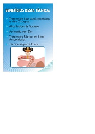 combate ejaculação precoce