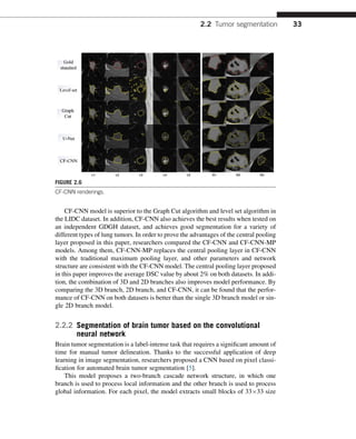 Radiomics And Its Clinical Application Artificial Intelligence And ...