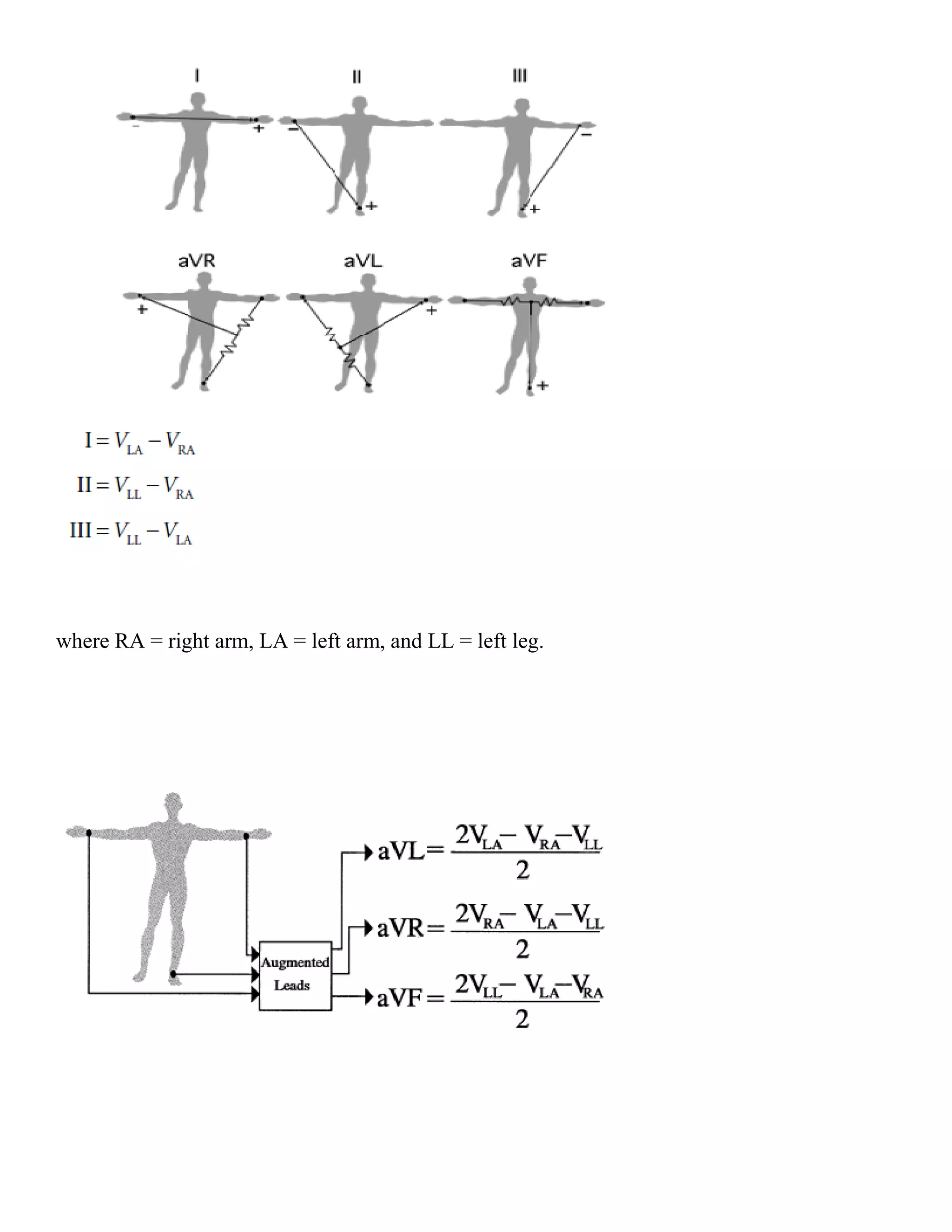 where RA = right arm, LA = left arm, and LL = left leg.
 