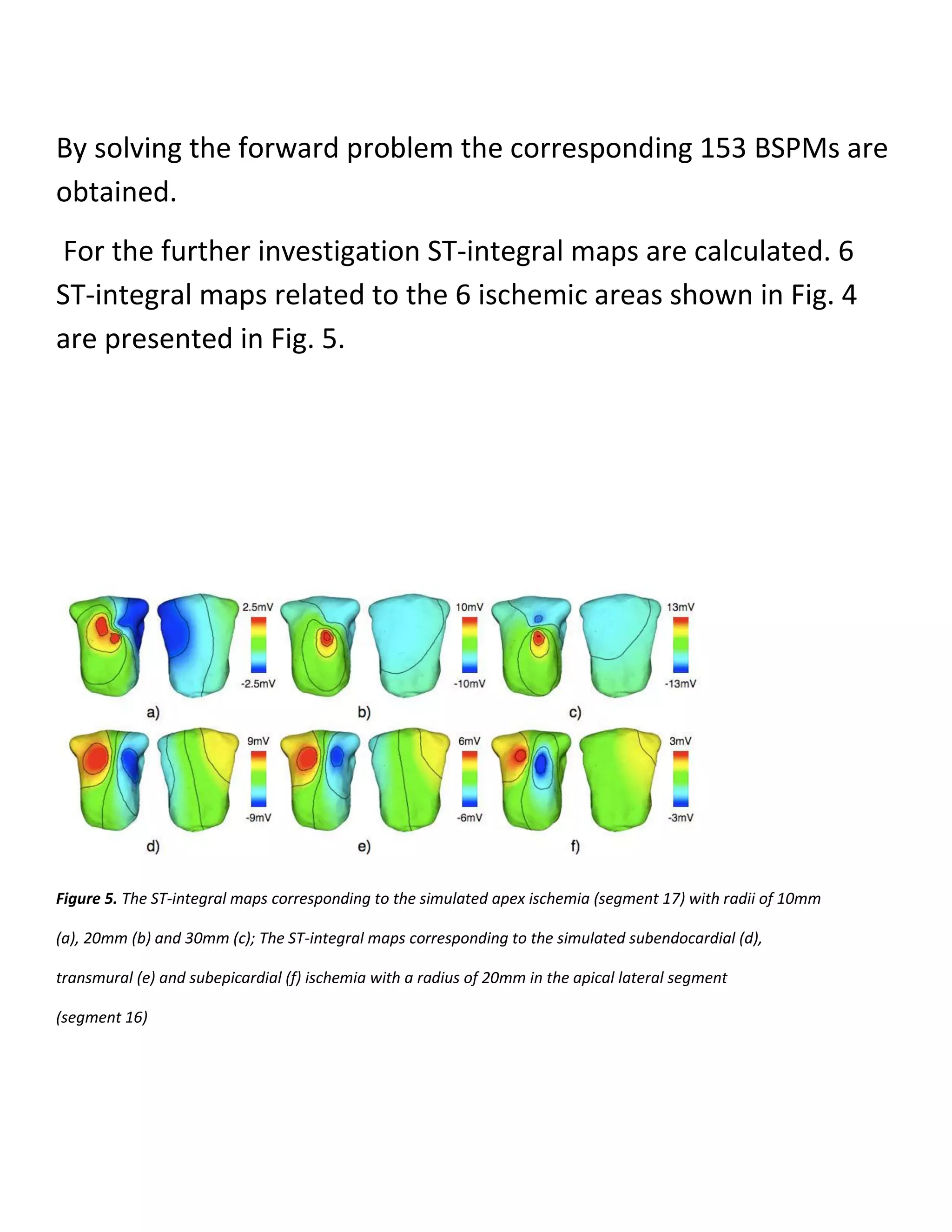 By solving the forward problem the corresponding 153 BSPMs are
obtained.
For the further investigation ST-integral maps are calculated. 6
ST-integral maps related to the 6 ischemic areas shown in Fig. 4
are presented in Fig. 5.
Figure 5. The ST-integral maps corresponding to the simulated apex ischemia (segment 17) with radii of 10mm
(a), 20mm (b) and 30mm (c); The ST-integral maps corresponding to the simulated subendocardial (d),
transmural (e) and subepicardial (f) ischemia with a radius of 20mm in the apical lateral segment
(segment 16)
 
