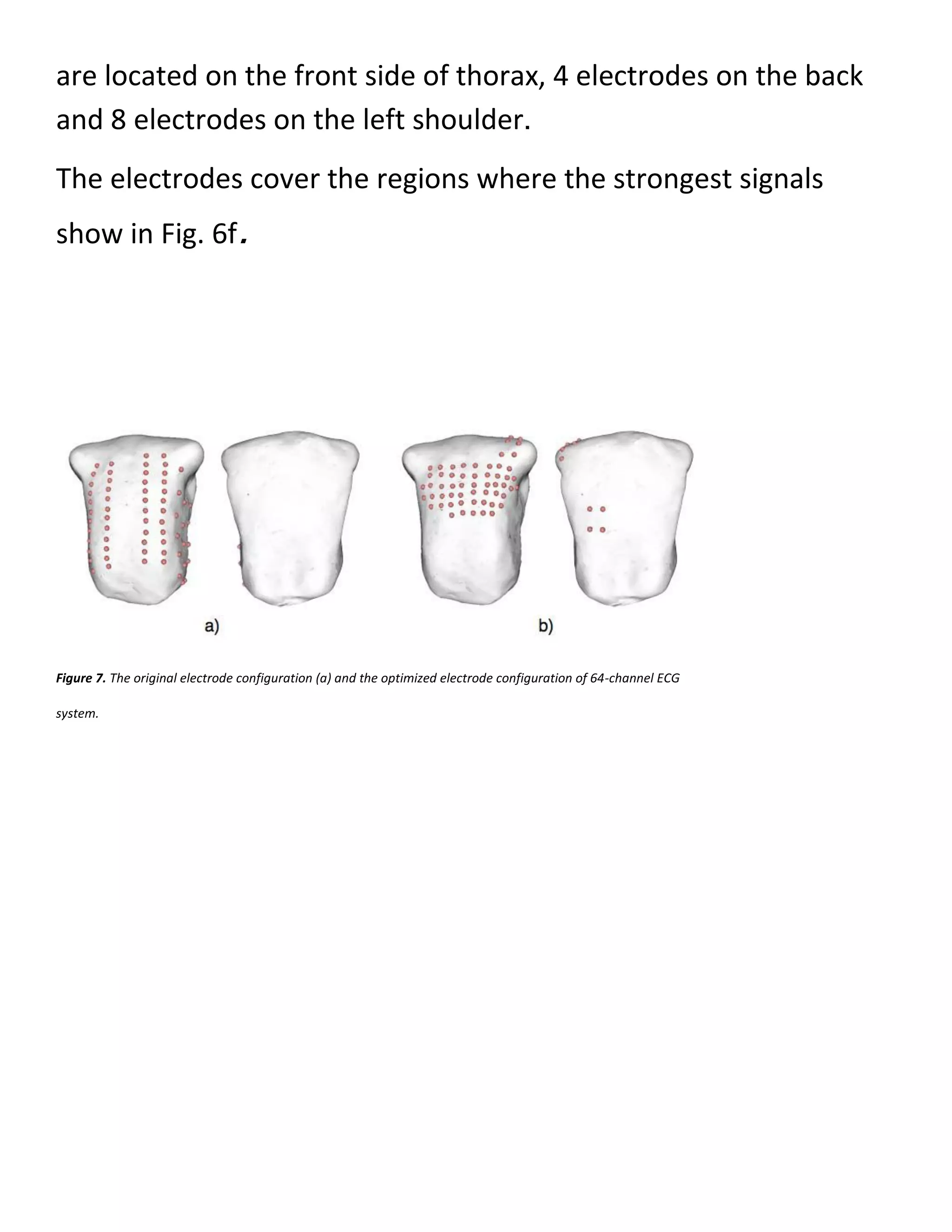 are located on the front side of thorax, 4 electrodes on the back
and 8 electrodes on the left shoulder.
The electrodes cover the regions where the strongest signals
show in Fig. 6f.
Figure 7. The original electrode configuration (a) and the optimized electrode configuration of 64-channel ECG
system.
 