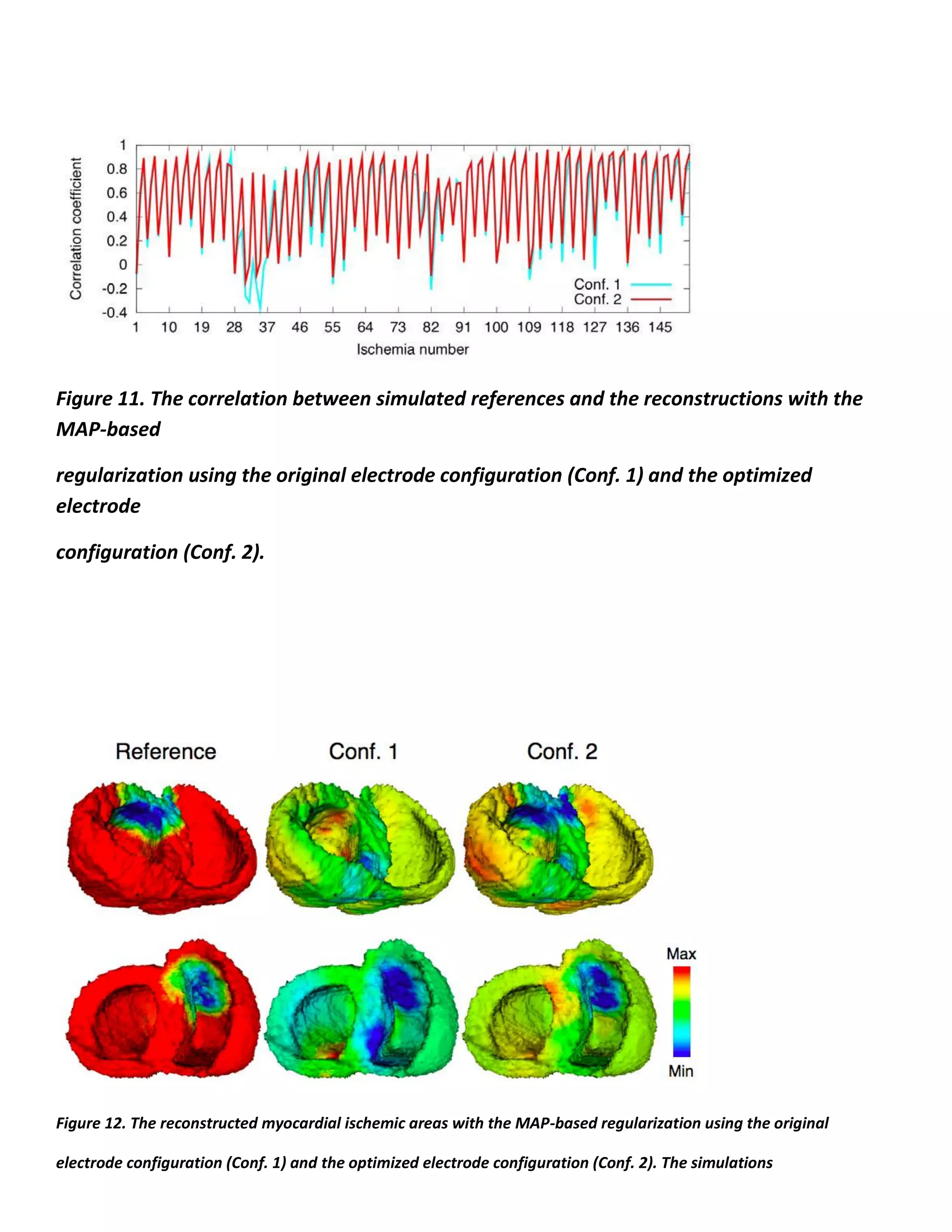 Figure 11. The correlation between simulated references and the reconstructions with the
MAP-based
regularization using the original electrode configuration (Conf. 1) and the optimized
electrode
configuration (Conf. 2).
Figure 12. The reconstructed myocardial ischemic areas with the MAP-based regularization using the original
electrode configuration (Conf. 1) and the optimized electrode configuration (Conf. 2). The simulations
 
