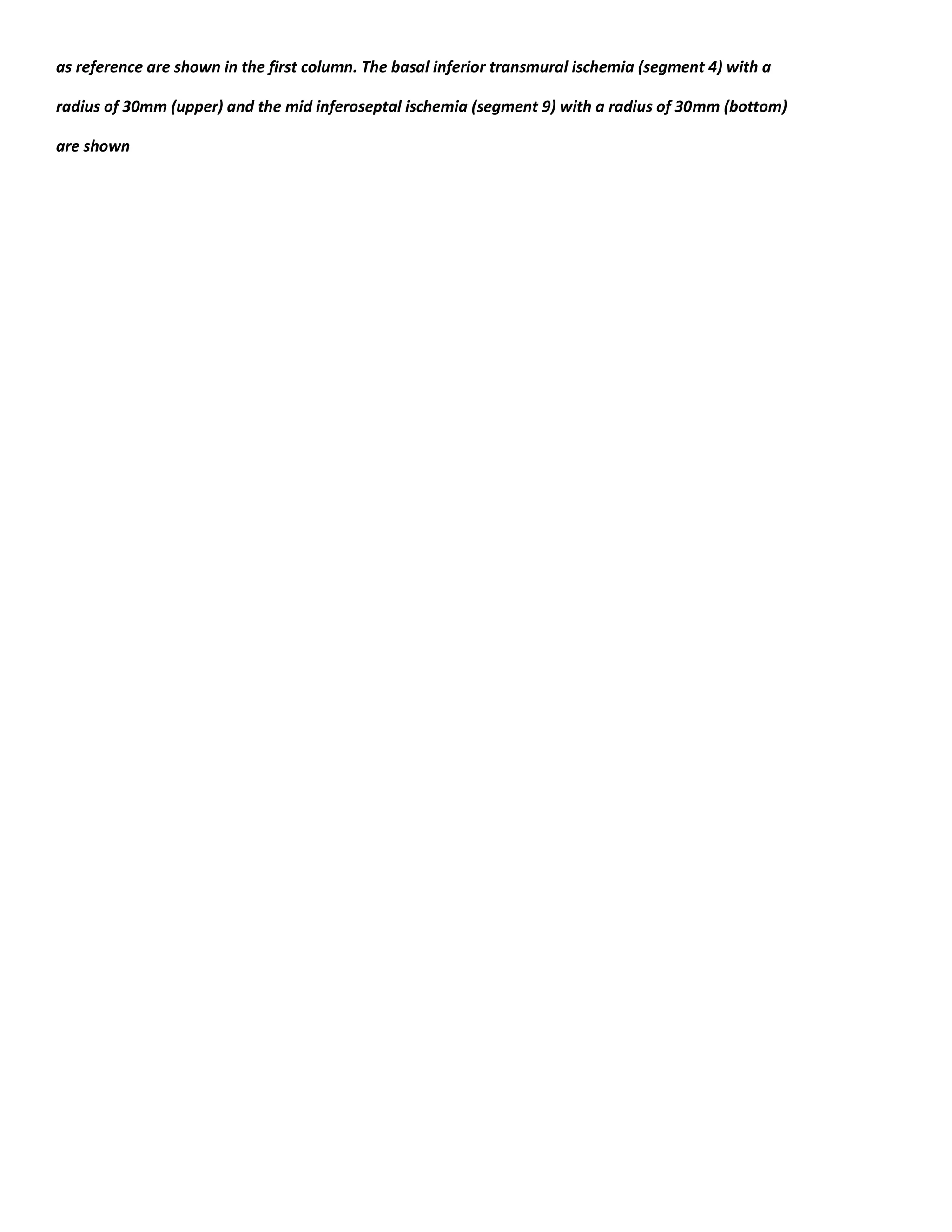 as reference are shown in the first column. The basal inferior transmural ischemia (segment 4) with a
radius of 30mm (upper) and the mid inferoseptal ischemia (segment 9) with a radius of 30mm (bottom)
are shown
 