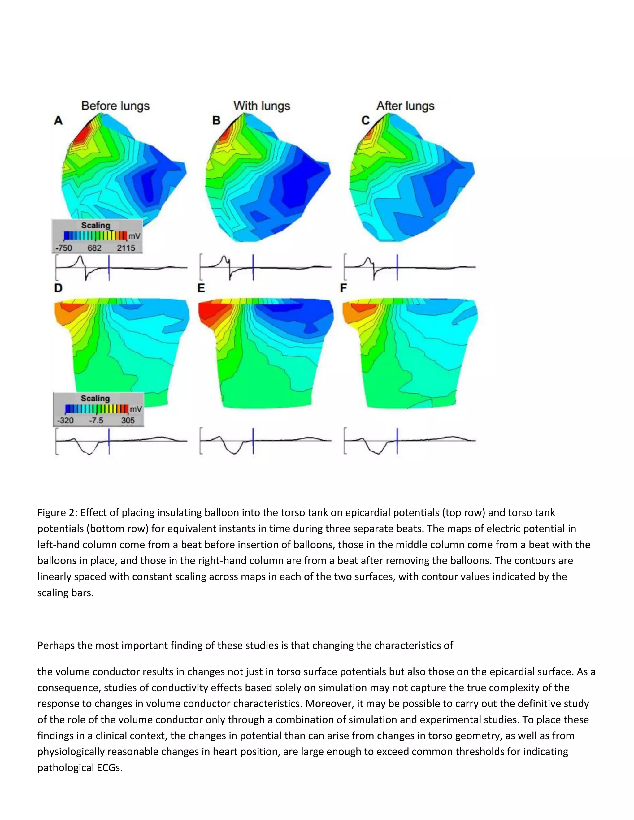 Figure 2: Effect of placing insulating balloon into the torso tank on epicardial potentials (top row) and torso tank
potentials (bottom row) for equivalent instants in time during three separate beats. The maps of electric potential in
left-hand column come from a beat before insertion of balloons, those in the middle column come from a beat with the
balloons in place, and those in the right-hand column are from a beat after removing the balloons. The contours are
linearly spaced with constant scaling across maps in each of the two surfaces, with contour values indicated by the
scaling bars.
Perhaps the most important finding of these studies is that changing the characteristics of
the volume conductor results in changes not just in torso surface potentials but also those on the epicardial surface. As a
consequence, studies of conductivity effects based solely on simulation may not capture the true complexity of the
response to changes in volume conductor characteristics. Moreover, it may be possible to carry out the definitive study
of the role of the volume conductor only through a combination of simulation and experimental studies. To place these
findings in a clinical context, the changes in potential than can arise from changes in torso geometry, as well as from
physiologically reasonable changes in heart position, are large enough to exceed common thresholds for indicating
pathological ECGs.
 