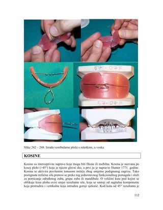 112
Slike 242 – 248. Izrada vestibularne ploče s rešetkom, u vosku
KOSINE
Kosine su interceptivne naprave koje mogu biti fiksne ili mobilne. Kosina je nazvana po
kosoj plohi (>45°) koja je njezin glavni dio, a prvi ju je napravio Hunter 1771. godine.
Kosina se aktivira povišenim tonusom mišića zbog umjetno podignutog zagriza. Tako
postignuta mišićna sila prenosi se preko tog jednostavnog funkcionalnog pomagala i služi
za pomicanje određenog zuba, grupe zuba ili mandibule. O veličini kuta pod kojim se
oblikuje kosa ploha ovisi smjer rezultante sile, koja se sastoji od sagitalne komponente
koja protrudira i vertikalne koja intrudira gornji sjekutić. Kod kuta od 45° rezultanta je
 