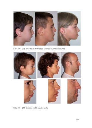 129
Slike 270 – 272. Tri osnovna profila lica – konveksni, ravni i konkavni
Slika 273 – 278. Ovisnost profila o dobi i spolu
 