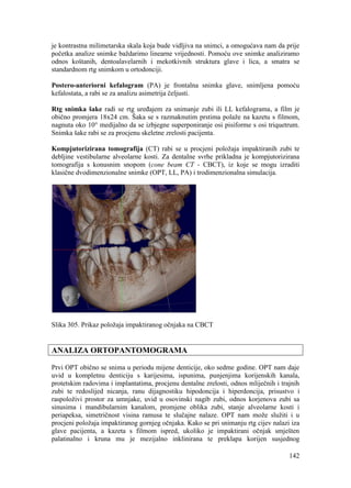 142
je kontrastna milimetarska skala koja bude vidljiva na snimci, a omogućava nam da prije
početka analize snimke baždarimo linearne vrijednosti. Pomoću ove snimke analiziramo
odnos koštanih, dentoalavelarnih i mekotkivnih struktura glave i lica, a smatra se
standardnom rtg snimkom u ortodonciji.
Postero-anteriorni kefalogram (PA) je frontalna snimka glave, snimljena pomoću
kefalostata, a rabi se za analizu asimetrija čeljusti.
Rtg snimka šake radi se rtg uređajem za snimanje zubi ili LL kefalograma, a film je
obično promjera 18x24 cm. Šaka se s razmaknutim prstima polaže na kazetu s filmom,
nagnuta oko 10° medijalno da se izbjegne superponiranje osi pisiforme s osi triquetrum.
Snimka šake rabi se za procjenu skeletne zrelosti pacijenta.
Kompjutorizirana tomografija (CT) rabi se u procjeni položaja impaktiranih zubi te
debljine vestibularne alveolarne kosti. Za dentalne svrhe prikladna je kompjutorizirana
tomografija s konusnim snopom (cone beam CT - CBCT), iz koje se mogu izraditi
klasične dvodimenzionalne snimke (OPT, LL, PA) i trodimenzionalna simulacija.
Slika 305. Prikaz položaja impaktiranog očnjaka na CBCT
ANALIZA ORTOPANTOMOGRAMA
Prvi OPT obično se snima u periodu mijene denticije, oko sedme godine. OPT nam daje
uvid u kompletnu denticiju s karijesima, ispunima, punjenjima korijenskih kanala,
protetskim radovima i implantatima, procjenu dentalne zrelosti, odnos mliječnih i trajnih
zubi te redoslijed nicanja, ranu dijagnostiku hipodoncija i hiperdoncija, prisustvo i
raspoloživi prostor za umnjake, uvid u osovinski nagib zubi, odnos korjenova zubi sa
sinusima i mandibularnim kanalom, promjene oblika zubi, stanje alveolarne kosti i
periapeksa, simetričnost visina ramusa te slučajne nalaze. OPT nam može služiti i u
procjeni položaja impaktiranog gornjeg očnjaka. Kako se pri snimanju rtg cijev nalazi iza
glave pacijenta, a kazeta s filmom ispred, ukoliko je impaktirani očnjak smješten
palatinalno i kruna mu je mezijalno inklinirana te preklapa korijen susjednog
 