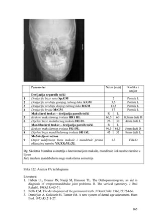 165
Parametar Nalaz (mm) Razlika i
smijer
Devijacija neparnih točki
1 Devijacija baze nosa Sp:GM 2 Pomak L
2 Devijacija sredinje gornjeg zubnog luka A:GM 3,5 Pomak L
3 Devijacija sredinje donjeg zubnog luka B:GM 13,5 Pomak L
4 Devijacija brade M:GM 17 Pomak L
Maksilarni trokut – devijacija parnih točki R L
5 Krakovi maksilarnog trokuta HR i HL 60,5 60 0,5mm duži D
6 Dijelovi baze maksilarnog trokuta IR i IL 26 30 4mm duži L
Mandibularni trokut – devijacija parnih točki R L
7 Krakovi maksilarnog trokuta PR i PL 96,5 61,5 5mm duži D
8 Dijelovi baze mandibularnog trokuta SR i SL 45 53 8mm duži L
Međučeljusni odnos
9 Omjer udaljenosti baza maksile i mandibule prema
okluzalnoj ravnini YR/ZR:YL/ZL
1,3 Viša D
Dg. Skeletna frontalna asimetrija s laterorotacijom maksile, mandibule i okluzalne ravnine u
lijevo
Jače izražena mandibularna nego maksilarna asimetrija
Slika 322. Analiza PA kefalograma
Literatura:
1. Habets LL, Bezuur JN, Naeiji M, Hansson TL. The Orthopantomogram, an aid in
diagnosis of temporomandibular joint problems. II. The vertical symmetry. J Oral
Rehabil. 1988;15:465-71.
2. Nolla CM. The development of the permanent teeth. J Dent Child. 1960;27:254-66.
3. Demirjian A, Goldstein H, Tanner JM. A new system of dental age assessment. Hum
Biol. 1973;45:211-27.
 