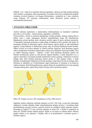 168
debljine 1 cm - kako bi se spriječio fenomen paralakse, odnosno prividni pomak položaja
zuba ukoliko se pomakne smjer promatranja. Na jednoj strani ima centimetarsku podjelu
označenu crvenim linijama, a na drugoj milimetarsku, s podjelom na 2 mm, označenu
crnim linijama. Pri mjerenju milimetarsku skalu okrenemo prema zubima, a
centimetarsku prema gore.
ANALIZA OKLUZIJE
Analiza okluzije registrirane u maksimalnoj interkuspidaciji na studijskim modelima
provodi se u tri ravnine – transverzalnoj, sagitalnoj i vertikalnoj.
Transverzalno, u fronti se analizira podudaranje sredina gornjeg i donjeg zubnog luka te
bilježi iznos i smjer odstupanja. Razlozi nepodudaranja mogu biti hiperdoncija,
hipodoncija, prerani gubitak zuba, zbijenost, prisilni zagriz ili prava skeletna asimetrija.
U lateralnom segmentu promatra se nadsvođuju li bukalne kvržice gornjih zubi donje, ili
postojanje križnog ili škarastog zagriza. Kod križnog zagriza gornji su zubi palatinalno
nagnuti, a donji bukalno te obuhvaćaju gornje zube, no postoji tuberkulo-fisurni kontakt.
Odnos kvržice na kvržicu također se smatra križnim zagrizom. Kod škarastog zagriza
zubi se međusobno mimoilaze poput krakova škara, bez tuberkulo-fisurnog kontakta. Dva
su oblika škarastog zagriza – bukalni i oralni. Kod bukalnog škarastog zagriza (ili
bukalne nonokluzije) gornji su zubi previše nagnuti bukalno, a donji lingvalno te se u
zagrizu mimoilaze ostvarujući kontakt palatinalne kvržice gornjeg s bukalnom kvržicom
donjeg zuba. Kod oralnog škarastog zagriza gornji su zubi nagnuti oralno, a donji
bukalno, kontaktirajući bukalnom kvržicom gornjeg s lingvalnom kvržicom donjeg zuba.
Potrebno je zabilježiti je li križni/škarasti zagriz jednostran ili obostran te na kojim je
zubima prisutan. Kod križnog/škarastog zagriza dolazi do neusklađenosti razvoja gornjeg
i donjeg zubnog luka, nepravilnog smjera nicanja zubi ili prisilnog zagriza.
Slika 324. Pregriz (overjet, OJ) i prijeklop (overbite, OB) inciziva
Sagitalna analiza uključuje mjerenje pregriza (overjet, OJ), koje se provodi mjerenjem
udaljenosti između labijalne plohe najretrudiranijeg donjeg inciziva i incizalnog brida
protrudiranijeg gornjeg inciziva, pomoću jezičca na stražnjem dijelu pomične mjerke.
Normalan je pregriz 2-3 mm, povećan upućuje na klasu II/1, a bridni ili negativan na
klasu III. Ukoliko postoji obrnuti pregriz, bilježi se na kojim se zubima nalazi. Obrnuti
pregriz odnosi se na sjekutiće i očnjake, dok se na premolarima i molarima govori o
križnom zagrizu.
 