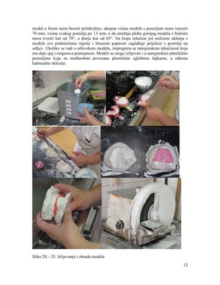 12
model u fronti mora brusiti polukružno, ukupna visina modela s postoljem mora iznositi
70 mm, visina svakog postolja po 13 mm, a da stražnja ploha gornjeg modela s bočnim
mora tvoriti kut od 70°, a donja kut od 65°. Na kraju tehničar još nožićem uklanja s
modela sva podminirana mjesta i brusnim papirom zaglađuje prijelaze s postolja na
odljev. Ukoliko se radi o arhivskom modelu, impregnira se namjenskom tekućinom koja
mu daje sjaj i osigurava postojanost. Modeli se mogu izlijevati i u namjenskim plastičnim
postoljima koja su međusobno povezana plastičnim zglobnim šipkama, u odnosu
habitualne okluzije.
Slike 20 – 25. Izlijevanje i obrada modela
 