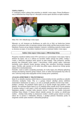 176
VISINA NEPCA
U vertikalnoj analizi zubnog luka potrebno je odrediti visinu nepca. Prema Korkhausu -
ona je definirana kao linija koja se s okuzijske ravnine spusti okomito na raphe medianu.
Slike 342 i 343. Određivanje visine nepca
Mjerenje se vrši šestarom po Korkhausu na način da se šiljci na krakovima šestara
postave u referentne točke za mjerenje stražnje širine (točke sjecišta transverzalne fisure s
bukalnom fisurom prvog trajnog kutnjaka) i pomoću vertikalnog nastavka šestara spusti
se okomica na nepce. Iz navedene vrijednosti može se izračunati indeks visine nepca:
Indeks visine nepca=visina nepca x 100/stražnja širina
Prosječna vrijednost indeksa iznosi 42% i povećava se s povećanjem visine nepca. Kad se
definira tip nepca, ono se u odnosu na navedeni indeks opisuje kao plitko, srednje i
visoko, a dobivena vrijednost može ujecati na plan terapije. Tako primjerice, ukoliko
pacijent ima bilateralni križni zagriz i istovremeno visoko gotsko nepce, rješavanje
anomalije može uključiti širenje gornjeg zubnog luka metodom forsiranog cijepanja
nepca. Ukoliko, pak, pacijent uz isti nalaz ima plitko nepce, ekstenzivno širenje gornje
čeljusti bit će kontraindicirano.
Etiološki - može se raditi o nasljednoj anomaliji, ali visoko nepce, kao obilježje apikalnog
suženja alveolarnog nastavka gornje čeljusti, često se nalazi kod pacijenata koji dišu na
usta i onih koji imaju neke nepogodne navike (sisanje prsta i predmeta).
ANALIZA SIMETRIJE U TRANSVERZALI
Kako bi se odredila simetrija zubnih lukova u transverzalnoj ravnini, potrebno je odrediti
referentnu medijalnu liniju. Ona se u gornjoj čeljusti određuje prema stabilnim
anatomskim strukturama na nepcu, a za sam je postupak potrebno locirati dvije točke –
prednju i stražnju. Na prednjem dijelu nepca to je sjecište drugih ruga palatina i rafe
palatine. Na stražnjem dijelu nepca to je ili središnja točka između dvije foveole palatine
ili prijelaz mekog u tvrdo nepce u liniji rafe palatini (projekcija spine nazalis posterior).
Spajanjem prednje i stražnje točke pomoću olovke i ravnala, na modelu ucrtavamo
središnju liniju čeljusti. U donjoj čeljusti također postoje dva načina za određivanje
sredine – stražnja točka dobije se prijenosom oznake s modela gornje čeljusti na donji,
nakon što se postave u habitualnu okluziju, a prednja pomoću frenuluma jezika ili
rengenske snimke spine mentalis u okluzalnoj projekciji.
 
