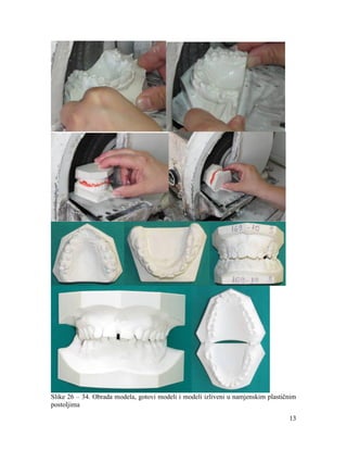 13
Slike 26 – 34. Obrada modela, gotovi modeli i modeli izliveni u namjenskim plastičnim
postoljima
 